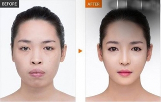 Top 11 Thẩm mỹ viện uy tín tại miền Bắc